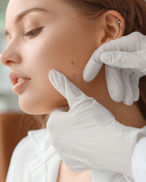 ほくろアートメイク１箇所１回